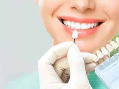 Transforme seu sorriso com facetas de porcelana de alta qualidade.