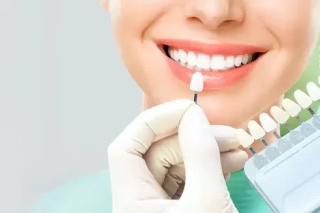 Transforme seu sorriso com facetas de porcelana de alta qualidade.